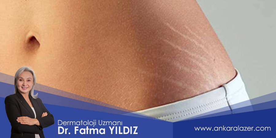catlak-tedavisi-fiyat