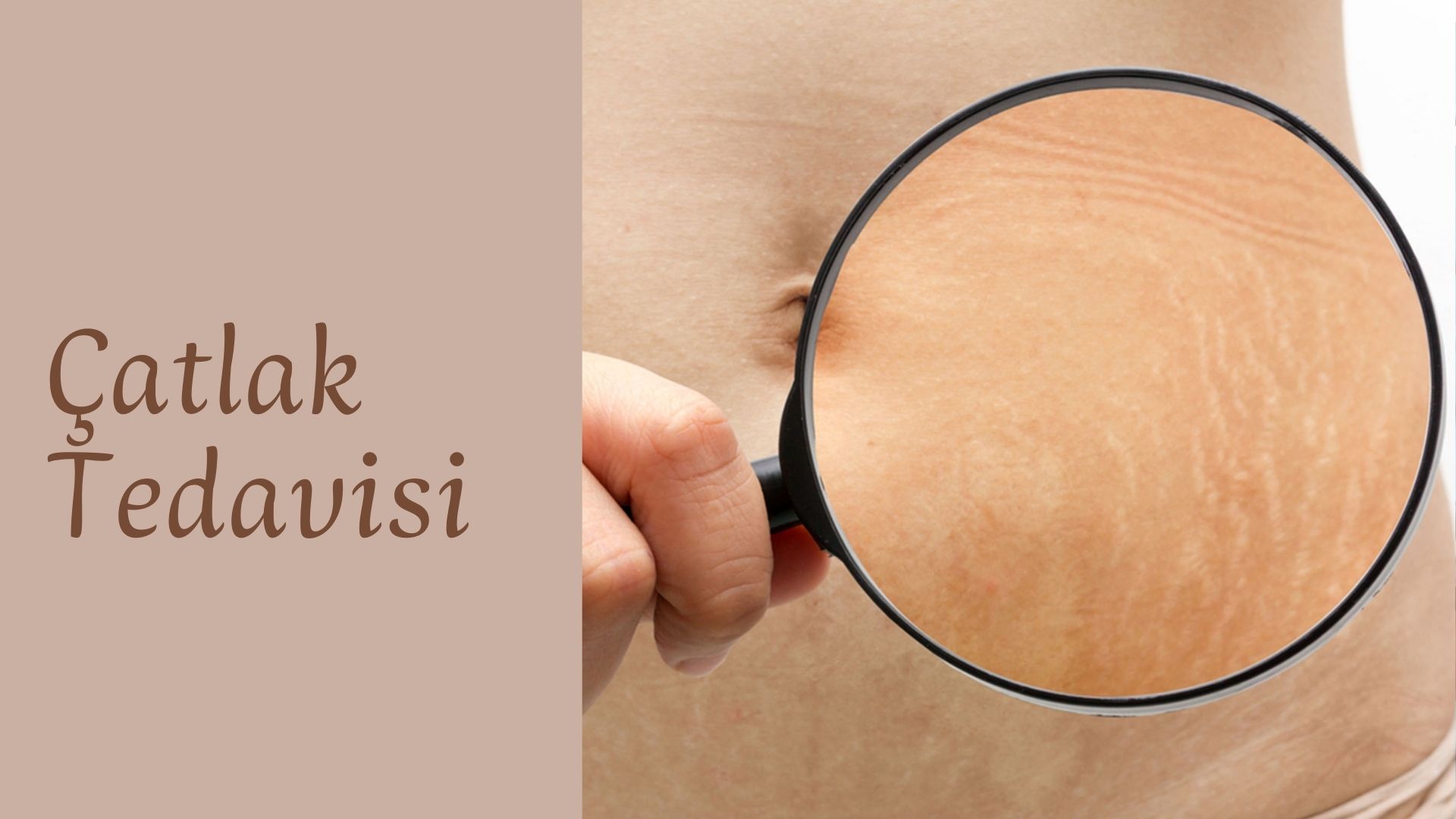 ankara-catlak-tedavisi