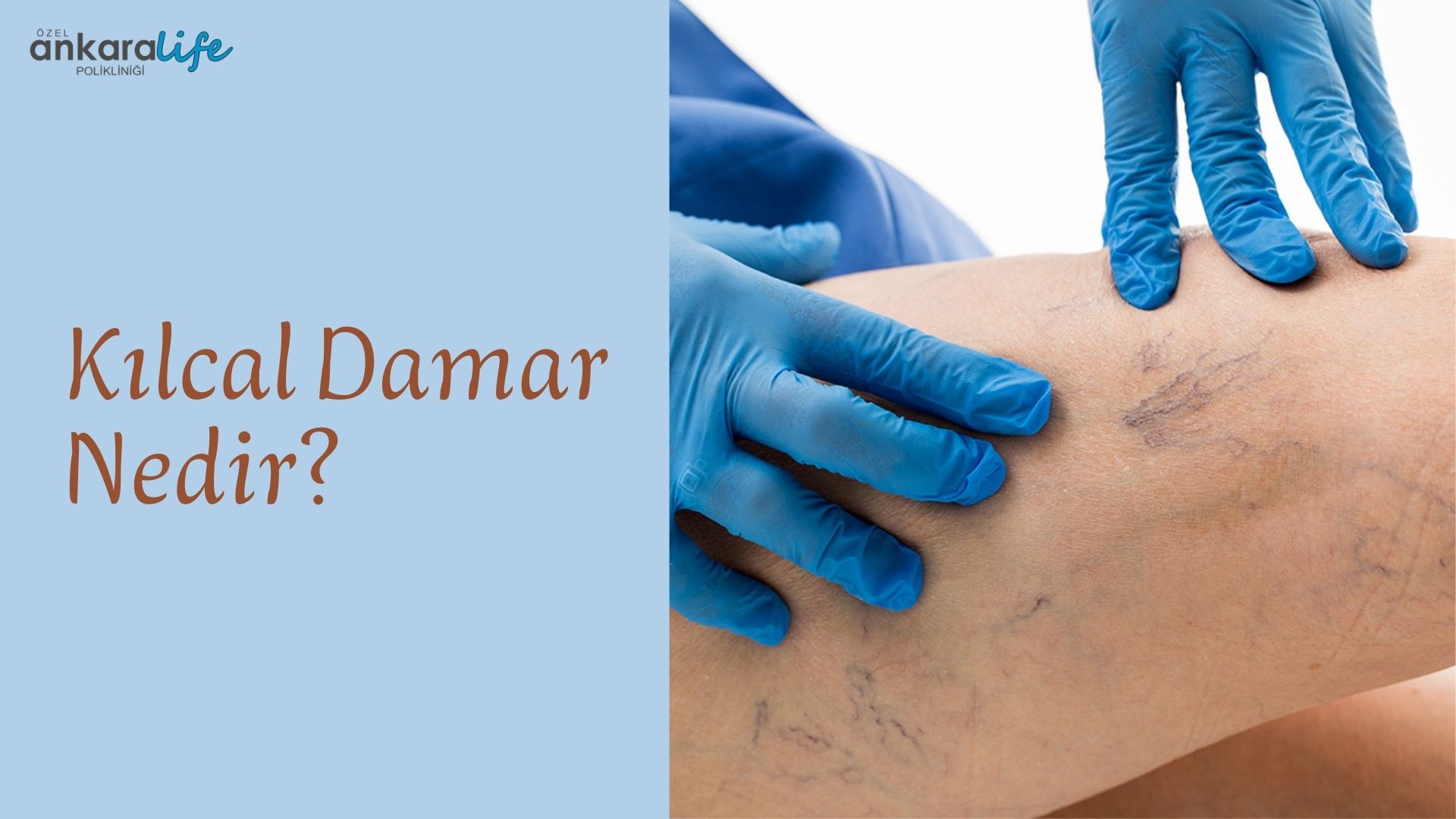 kilcal-damar-nedir