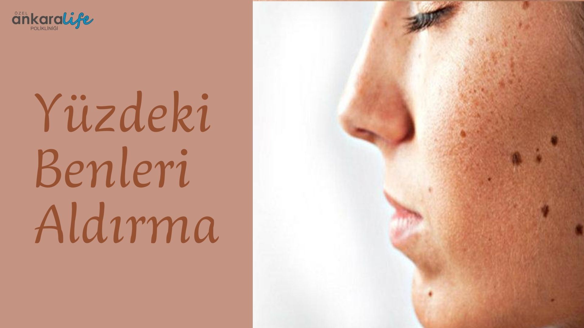 yuzdeki-benleri-aldirma