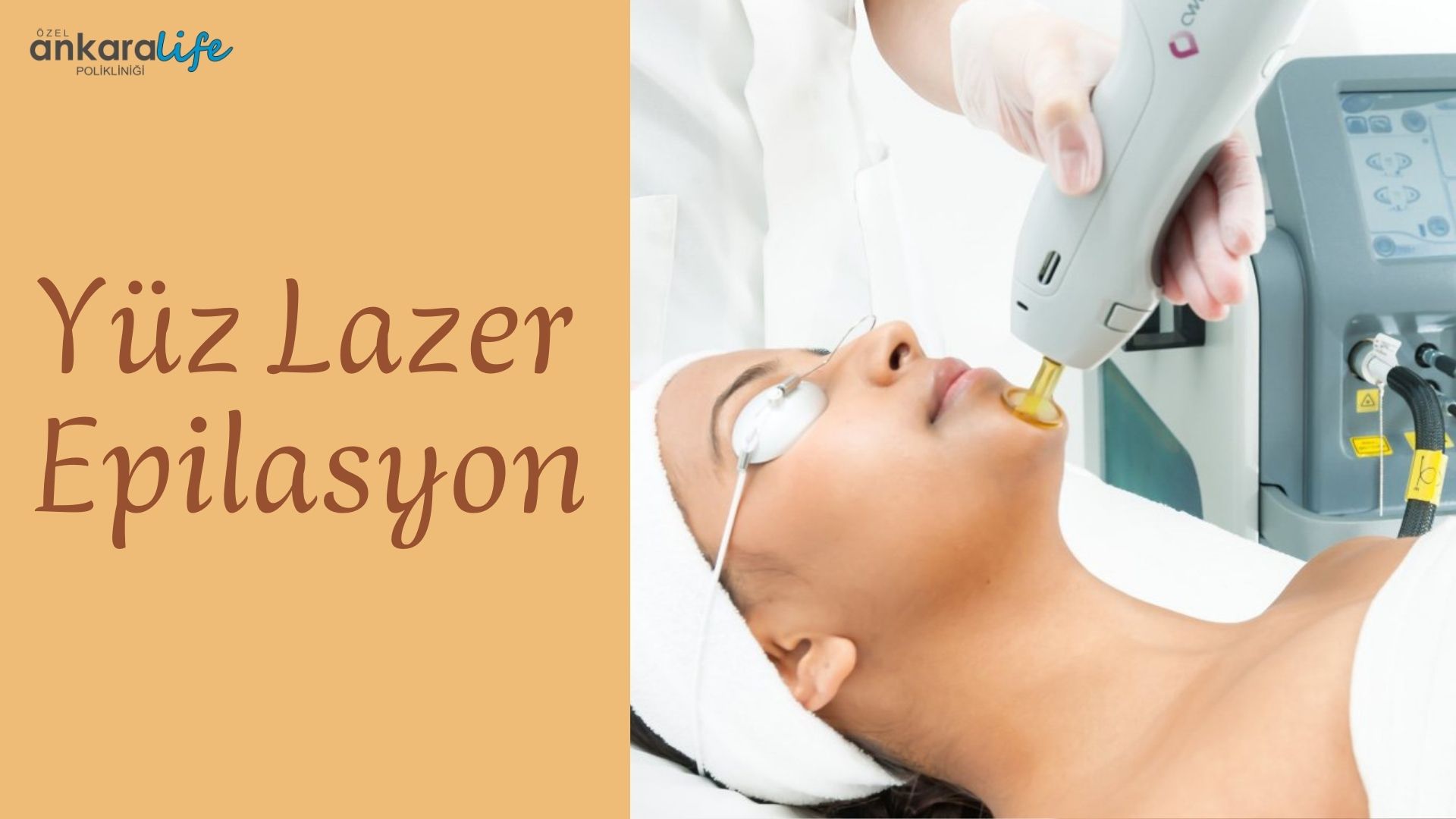 yuze-lazer-epilasyon