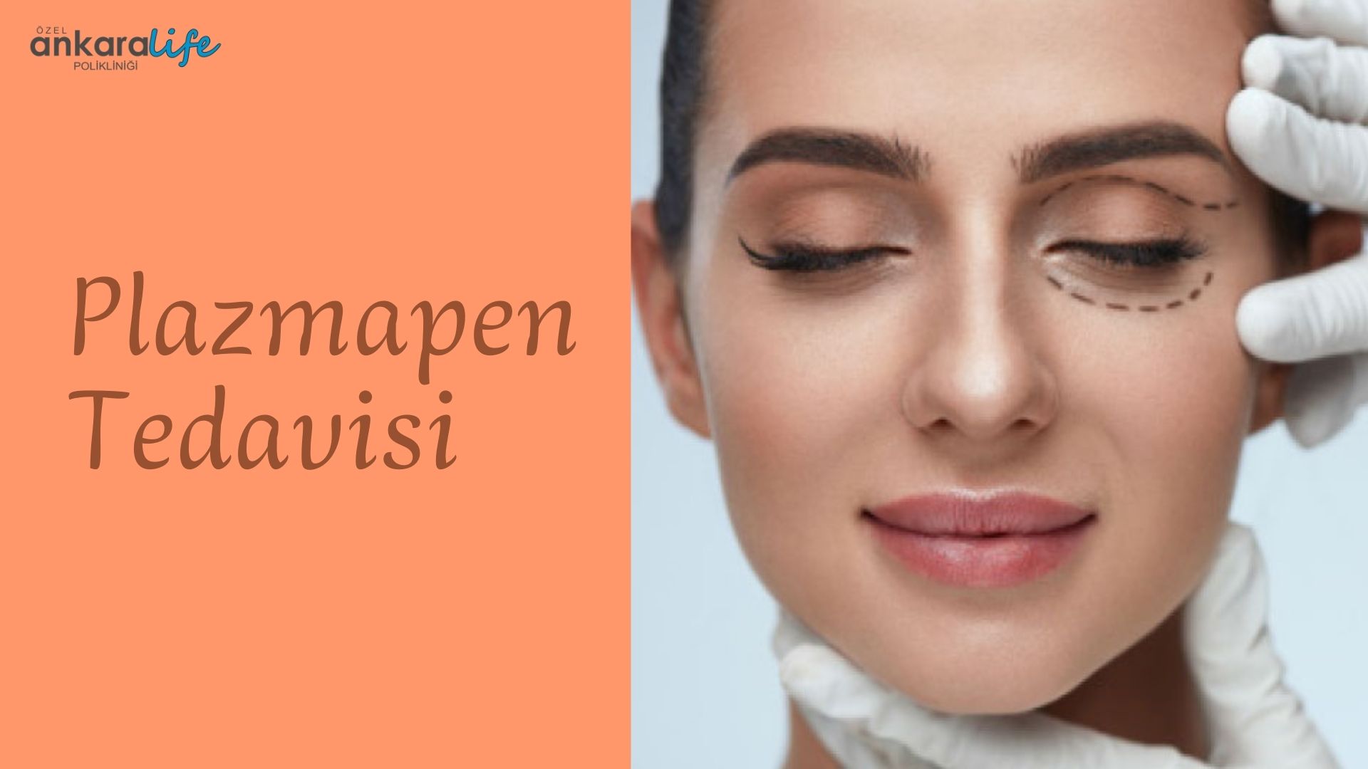 plazmapen-tedavisi