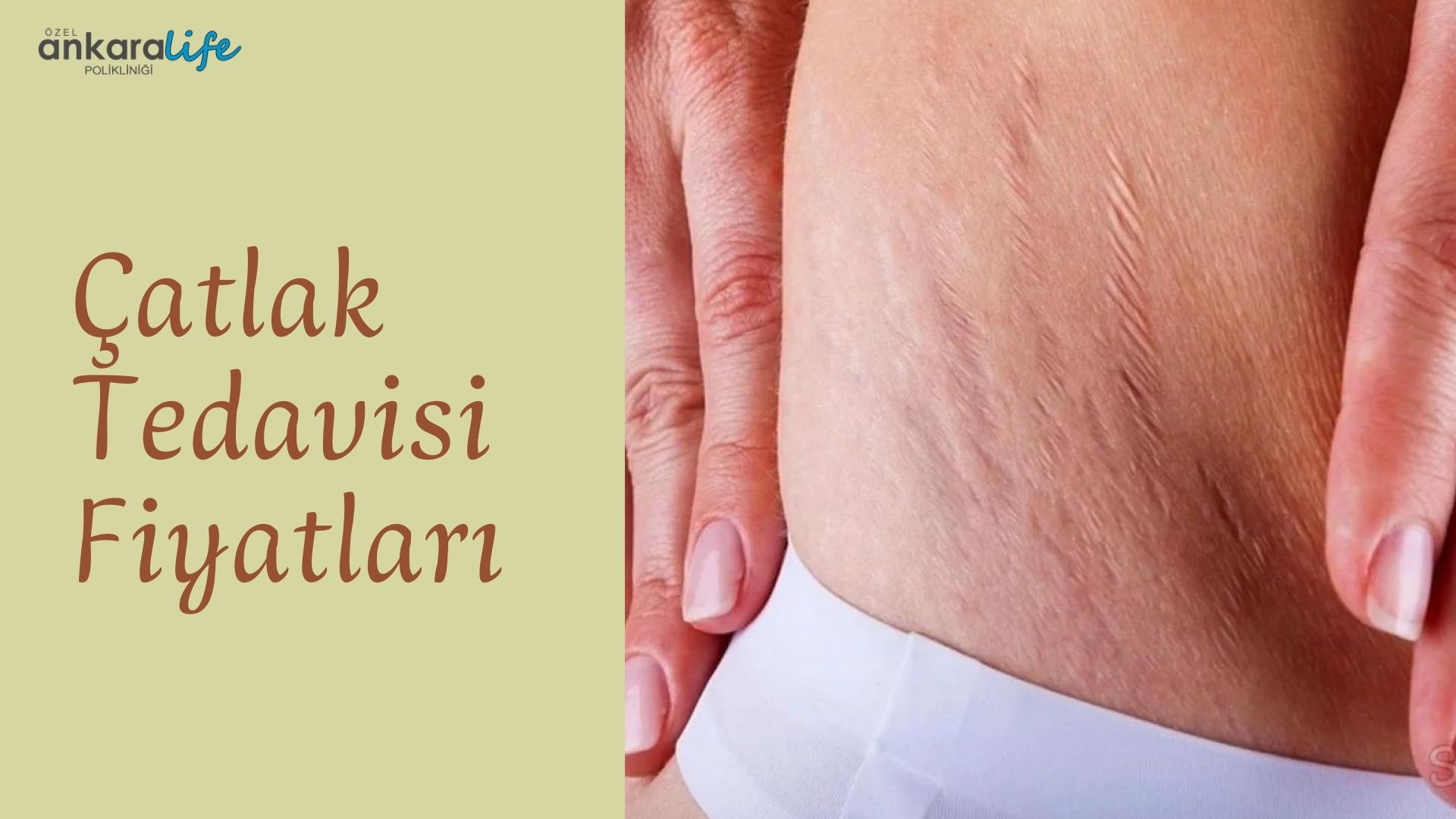 catlak-tedavisi-fiyatlari
