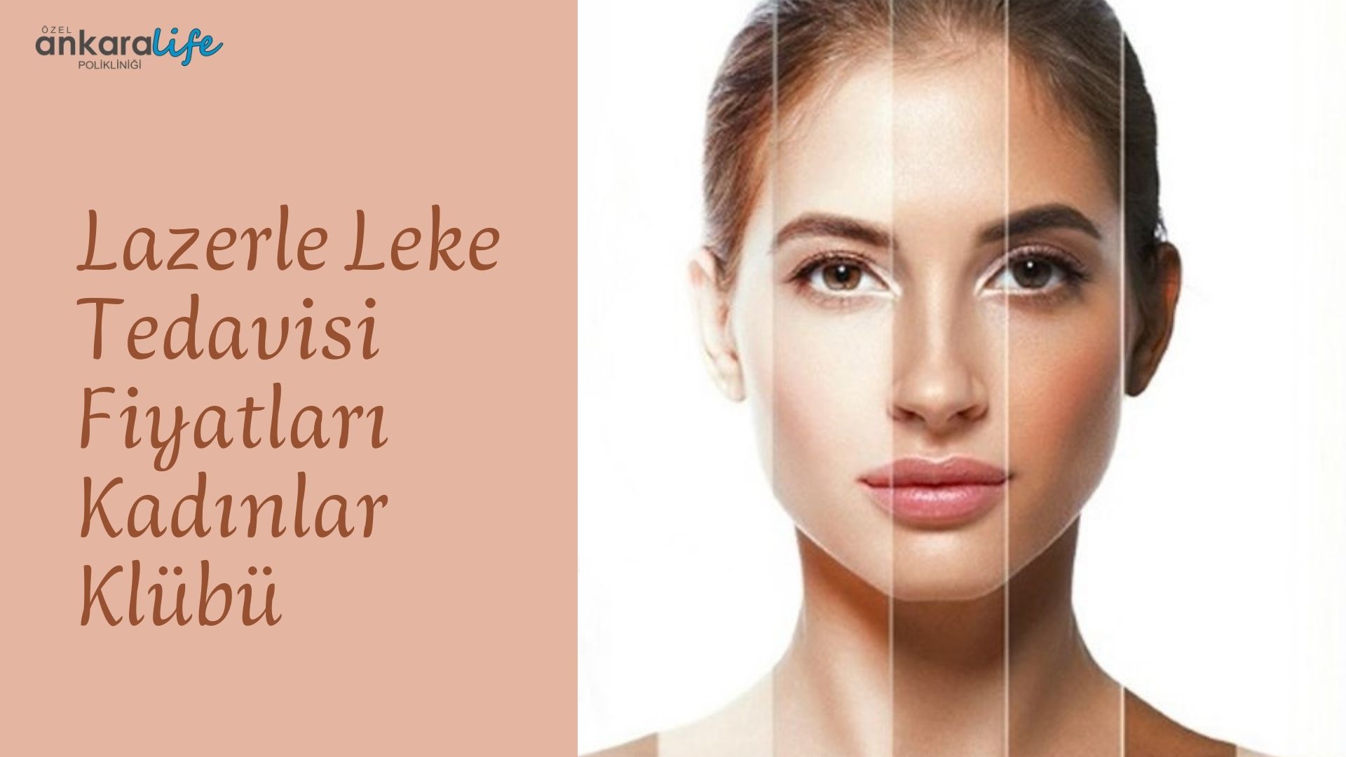 lazerle-leke-tedavisi-fiyatlari-kadinlar-kulubu