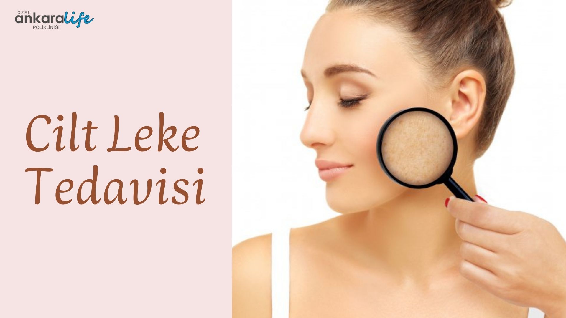 cilt-leke-tedavisi