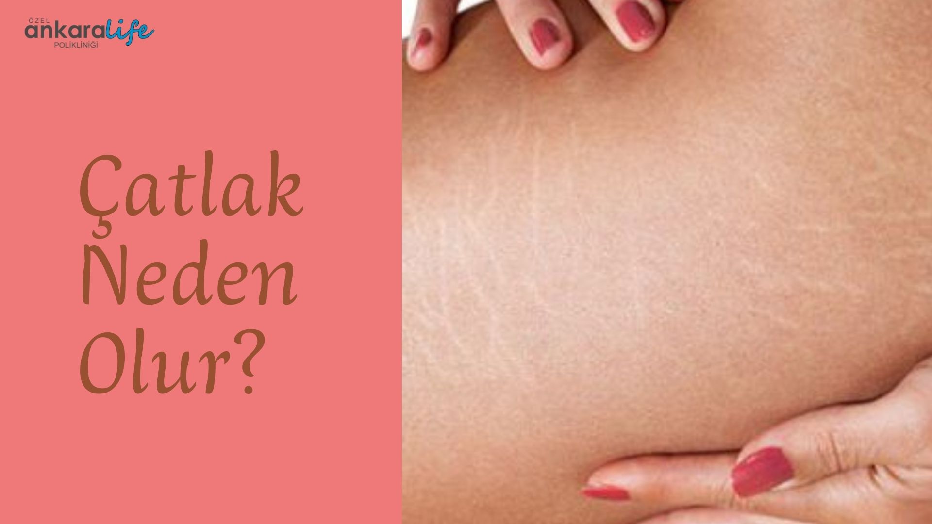 catlak-neden-olur