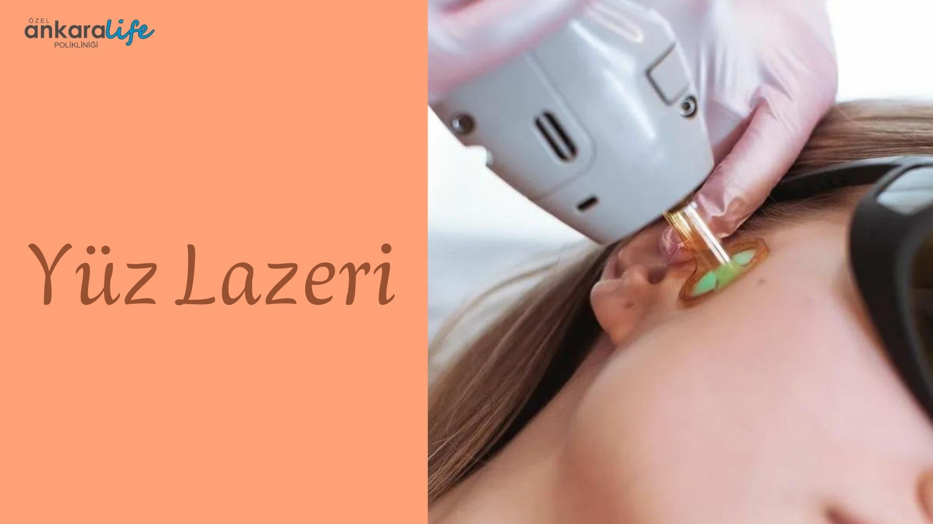 yuz-lazeri