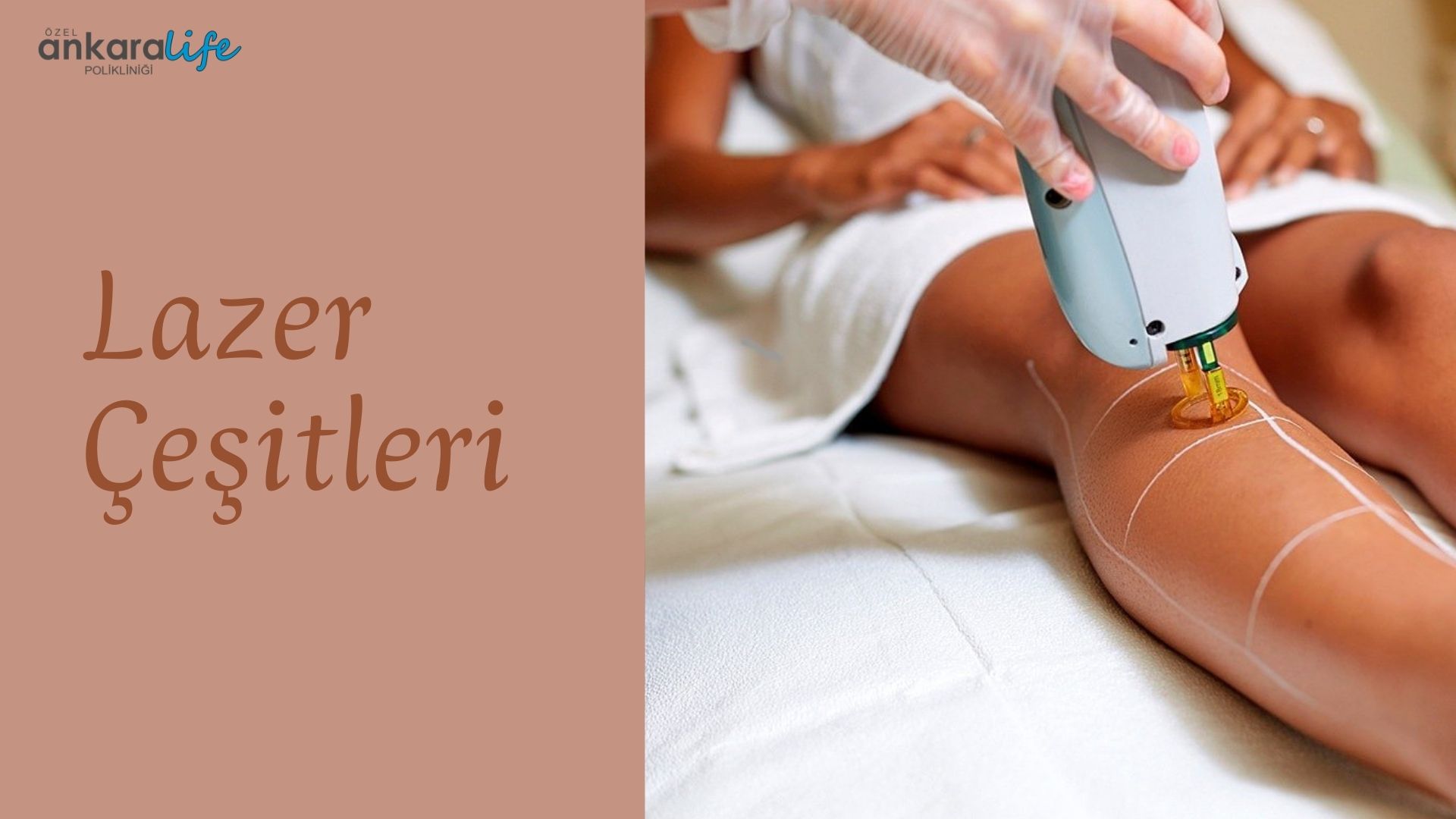 lazer-çeşitleri