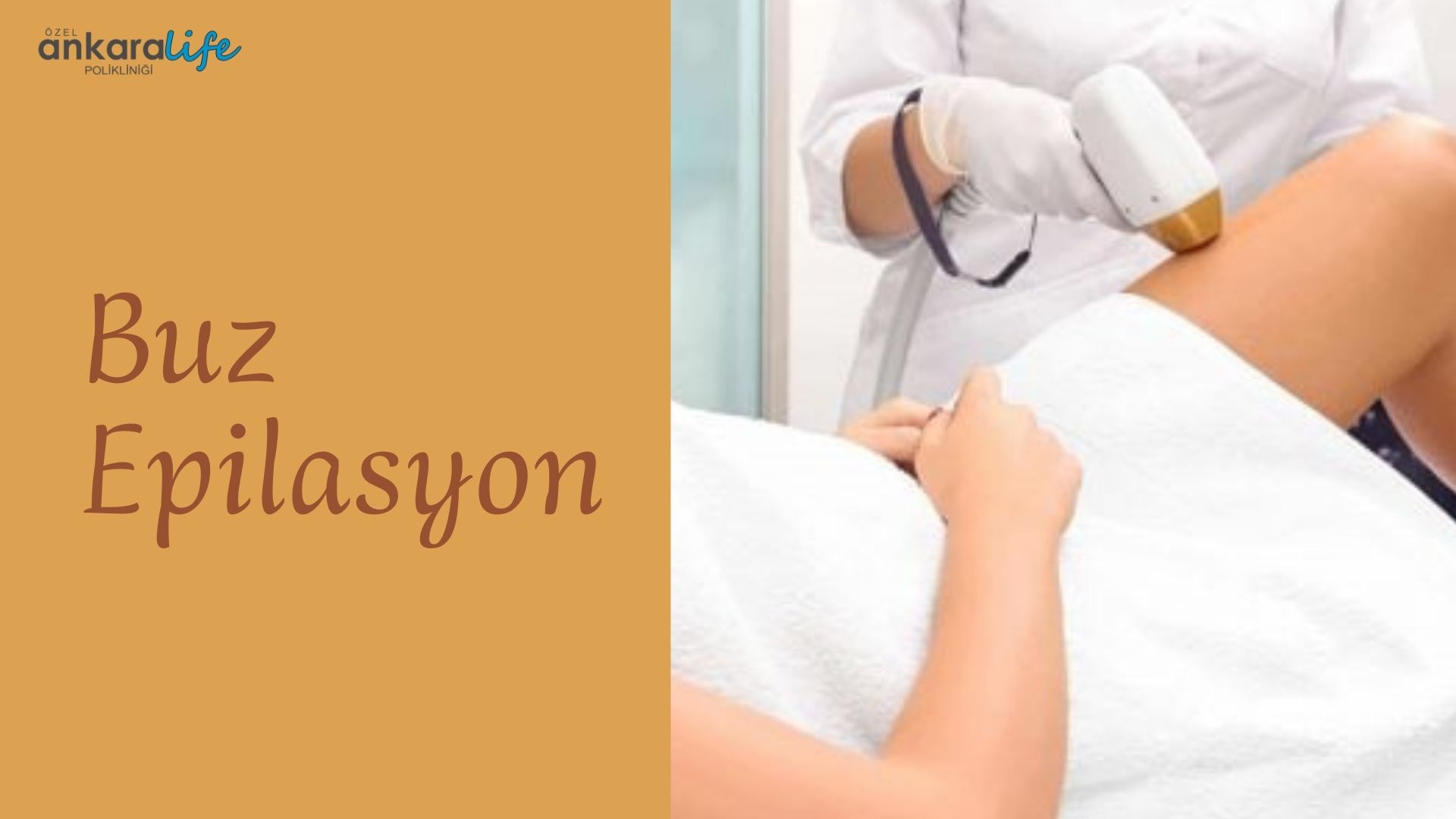 buz-epilasyon