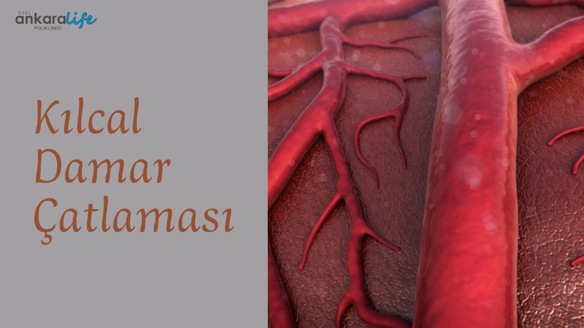 kılcal-damar-catlamasi