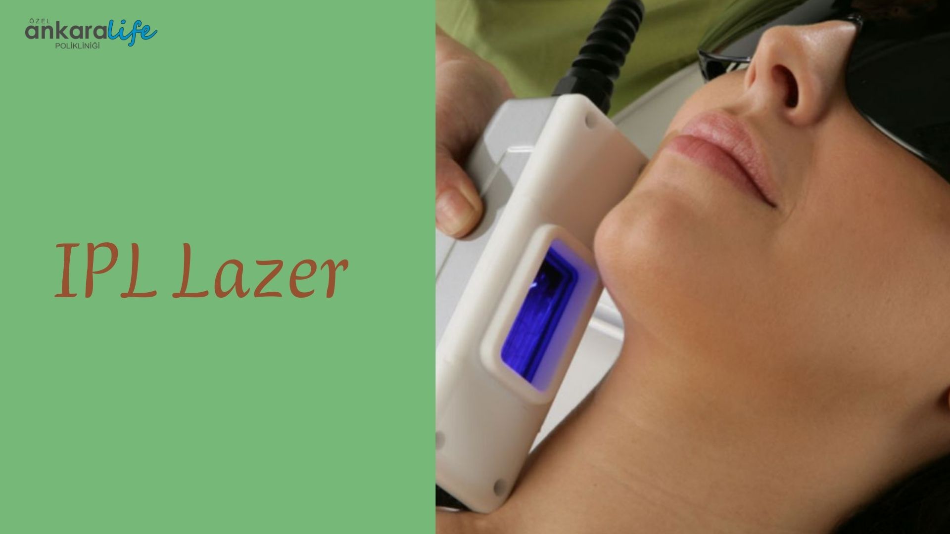 ipl-lazer