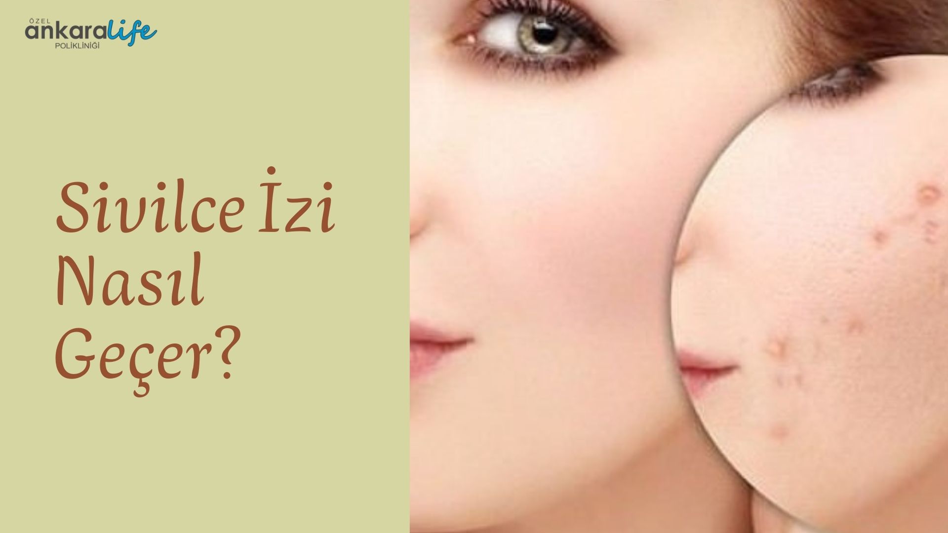 Blog Deneme 1