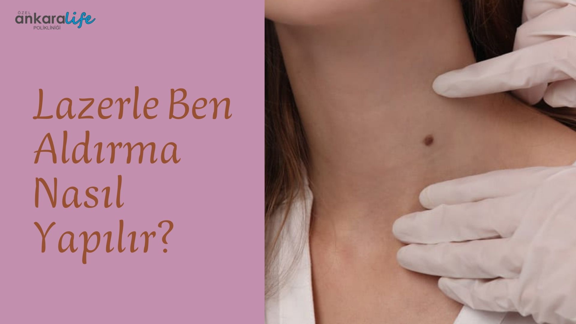 Blog Deneme 1