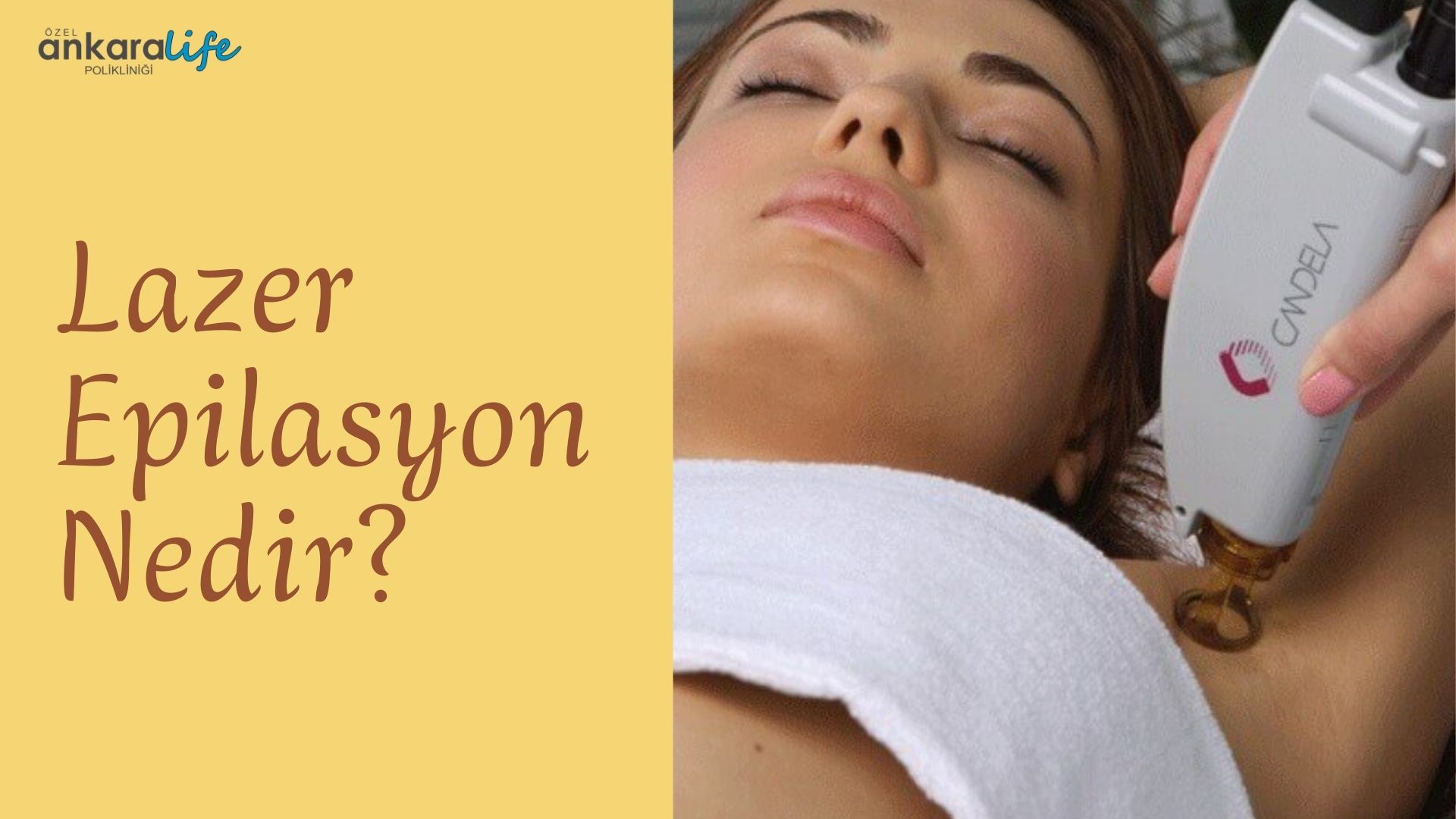 lazer-epilasyon-nedir