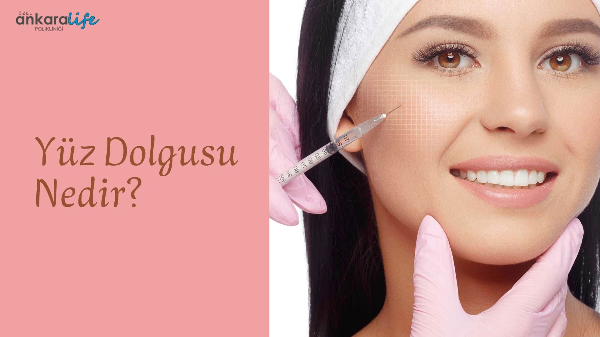 Yüz Dolgusu Nedir