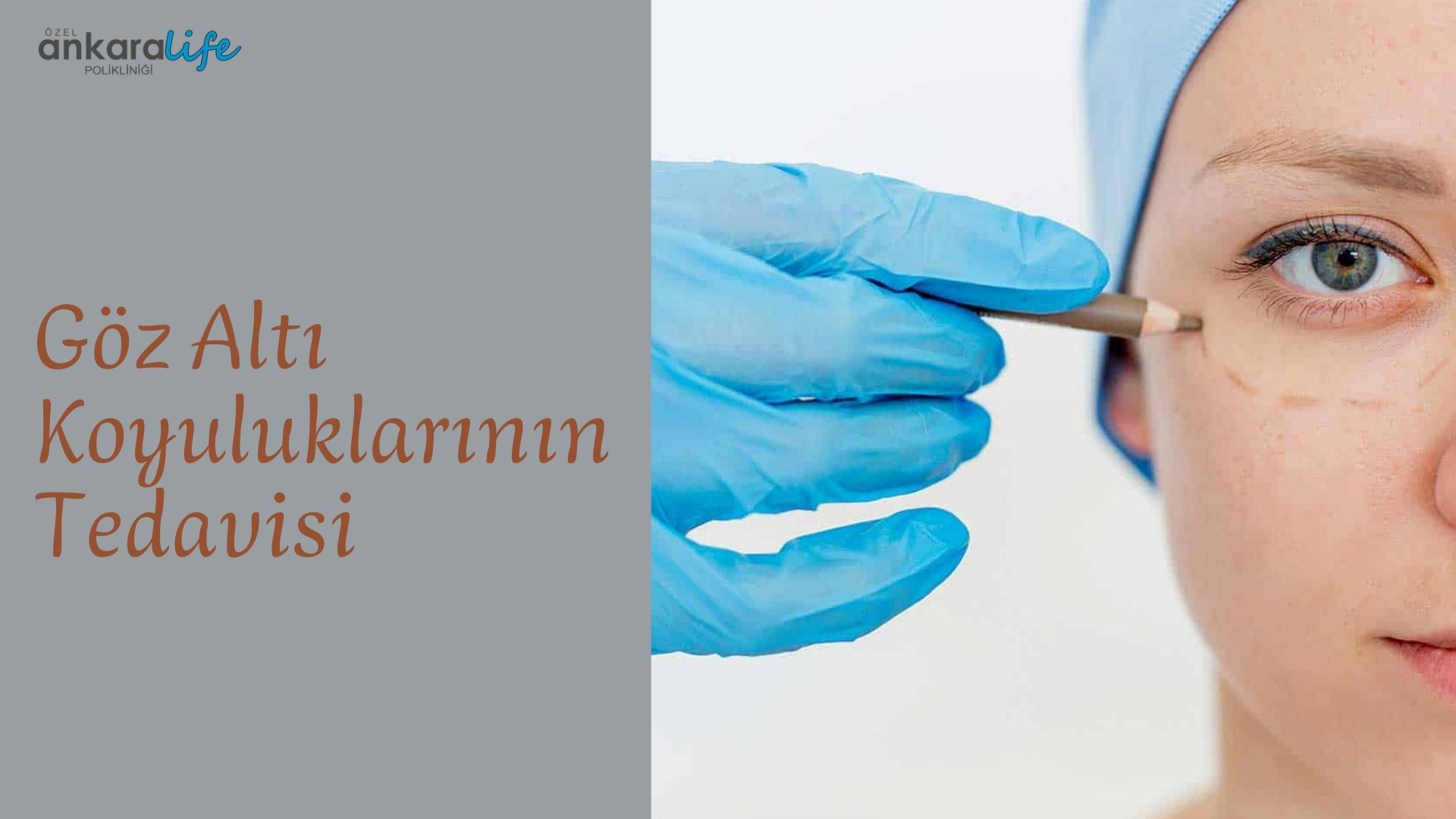 Göz Altı Koyuluklarının Tedavisi