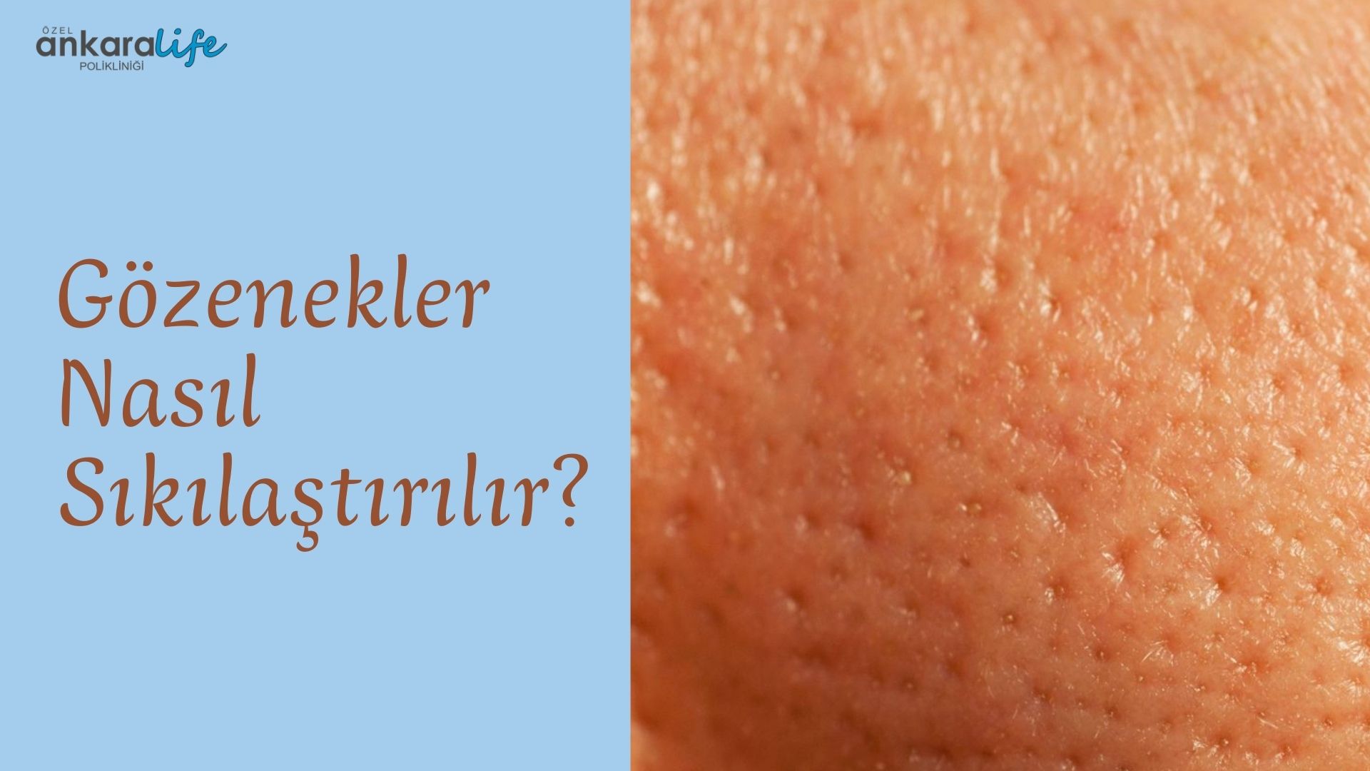 gozenekler-nasil-sikilastirilir