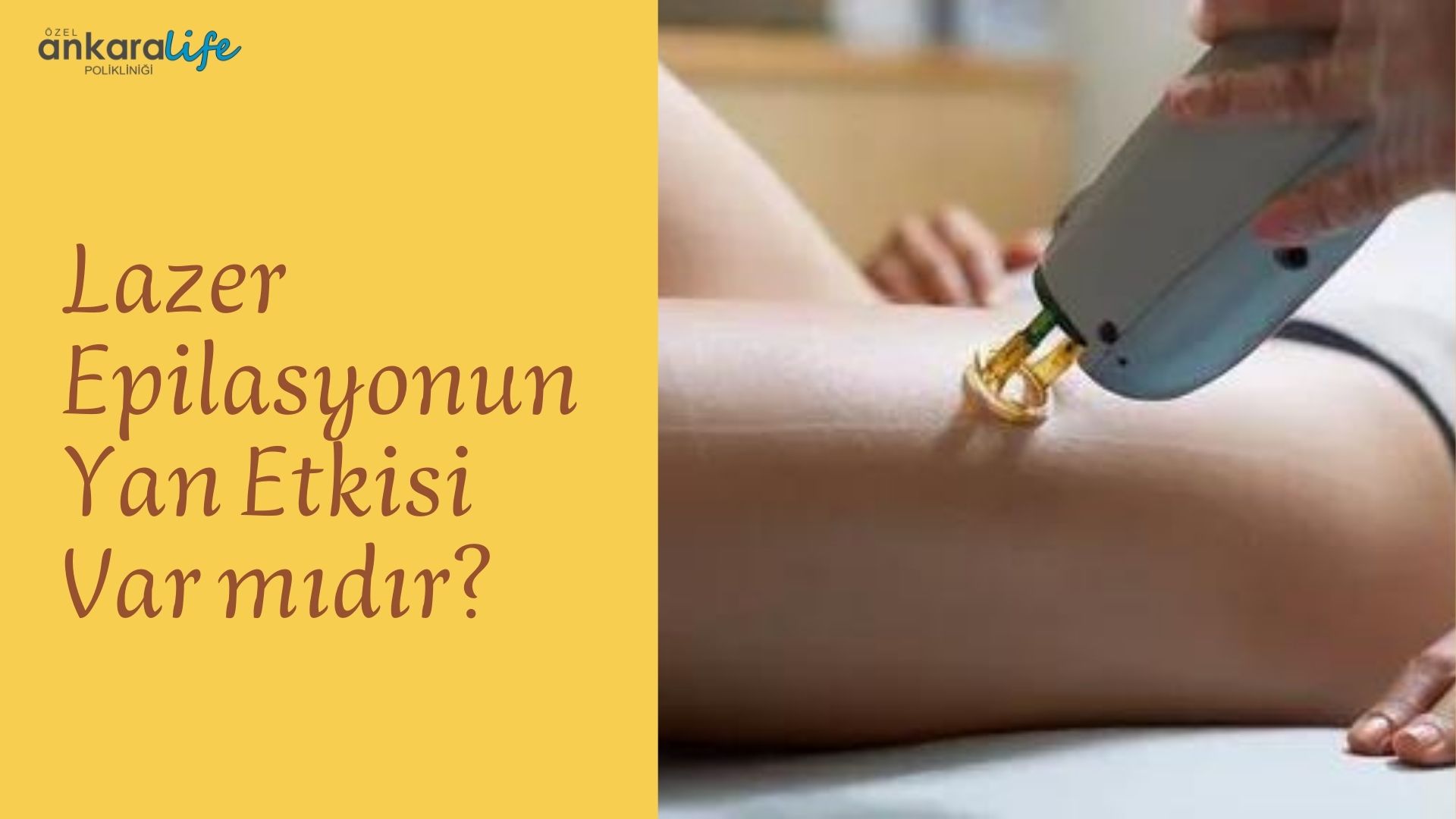lazer-epilasyon-yan-etki