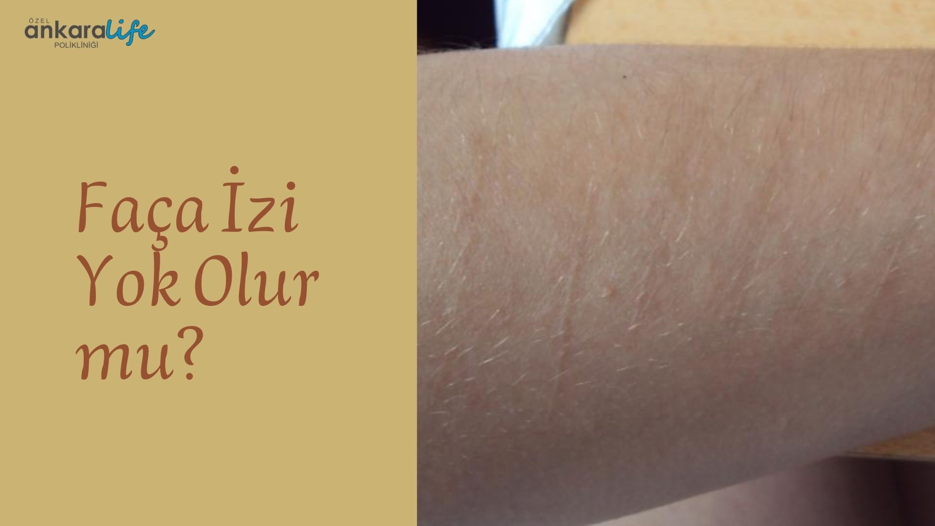 faca-izi