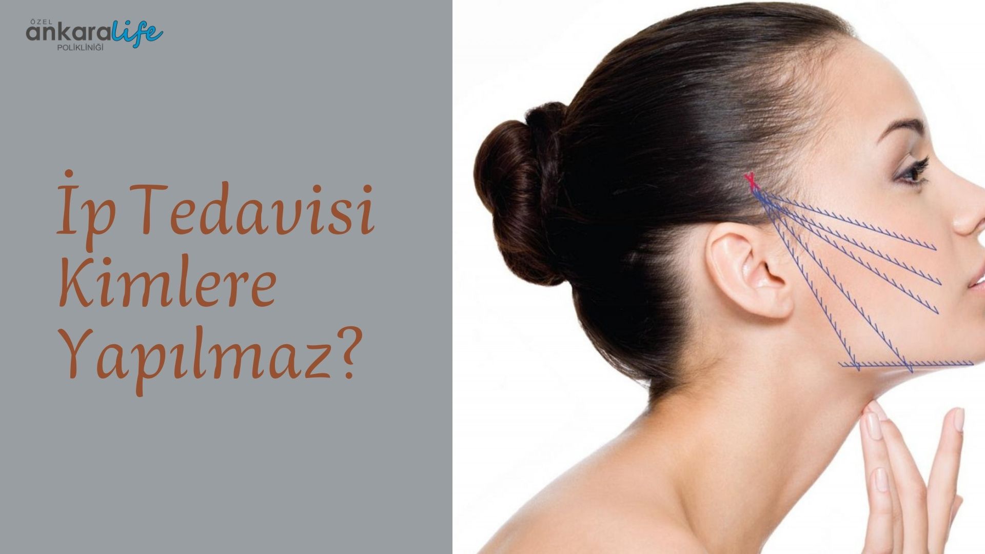 ip-tedavisi