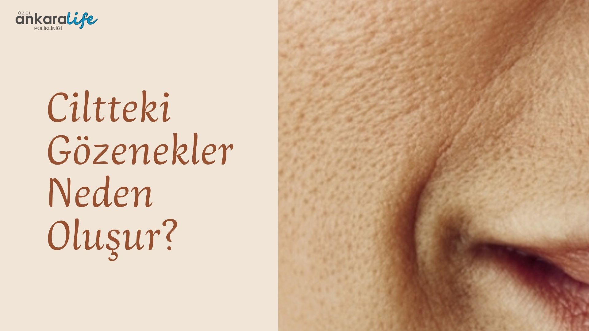 ciltteki-gözenekler