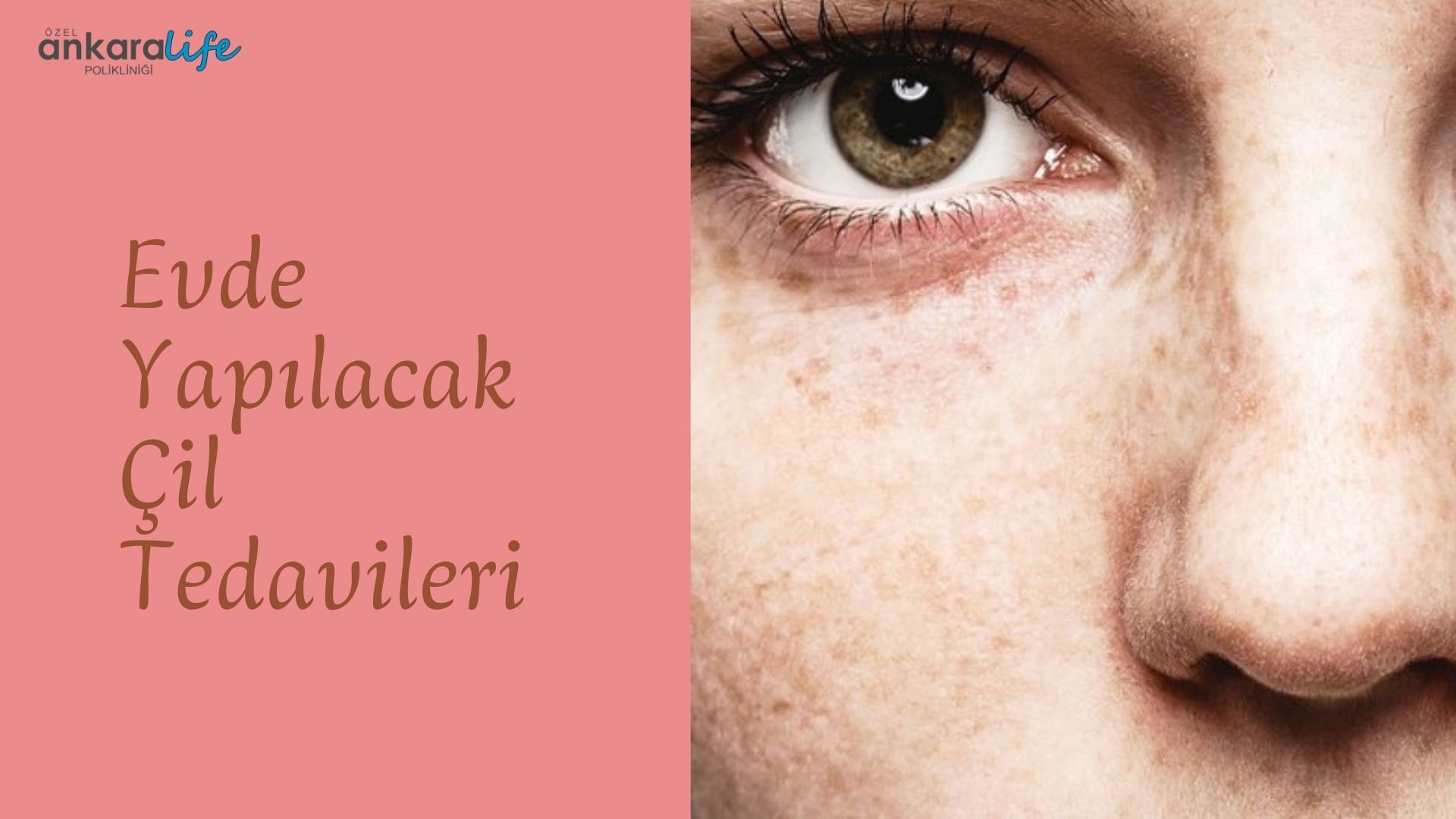 evde-yapilacak-cil-tedavileri