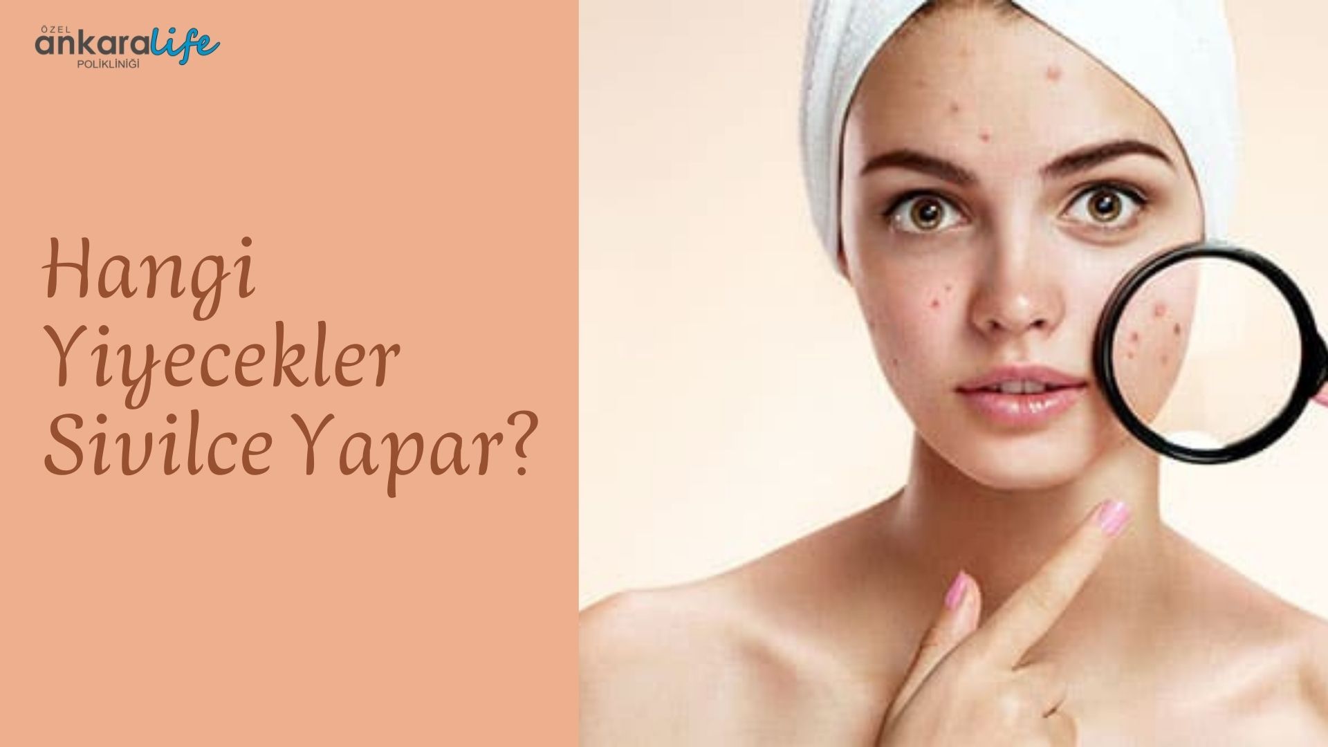 Sivilce-yapan-yiyecekler