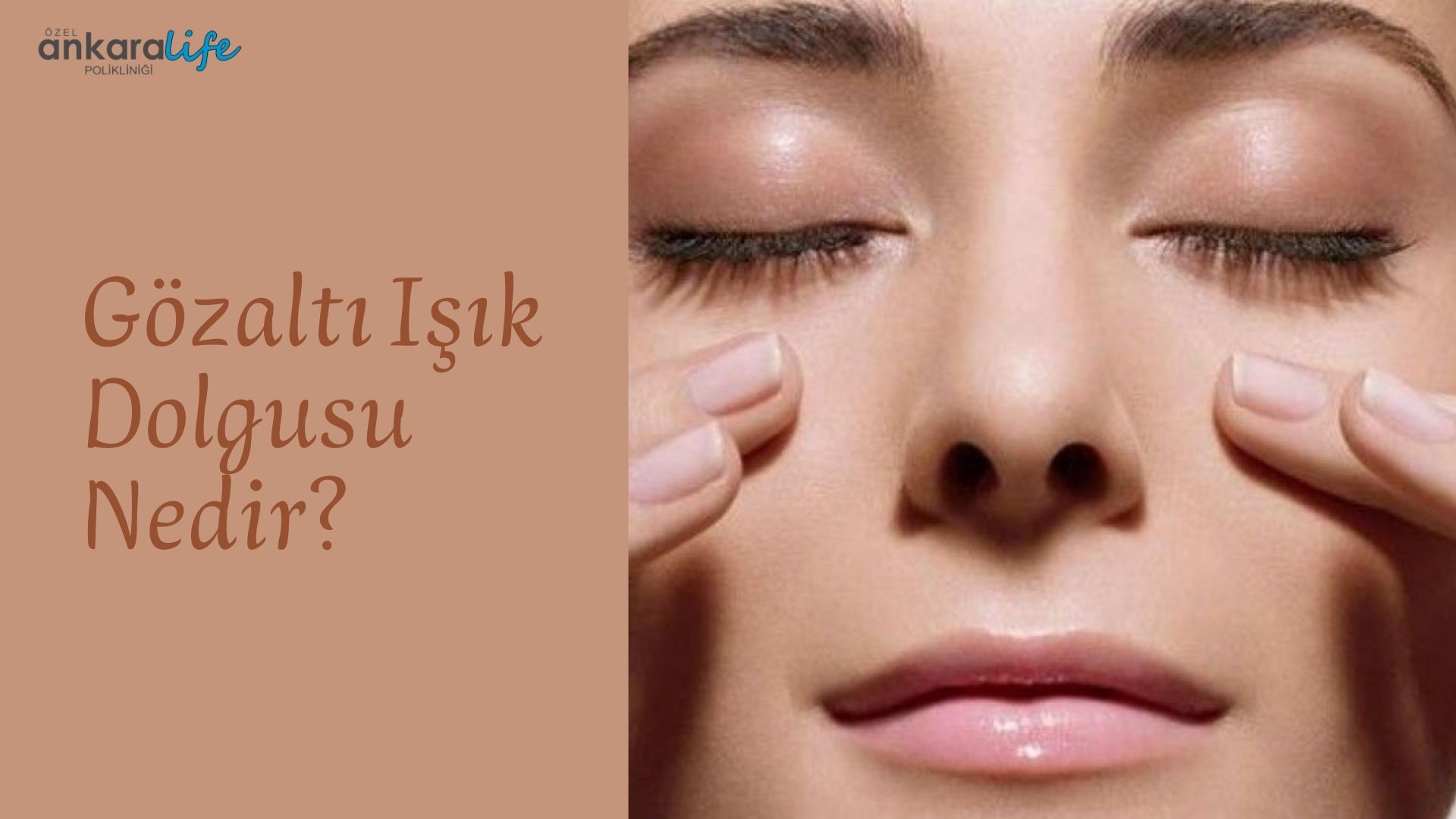 Gözaltı Işık Dolgusu Nedir