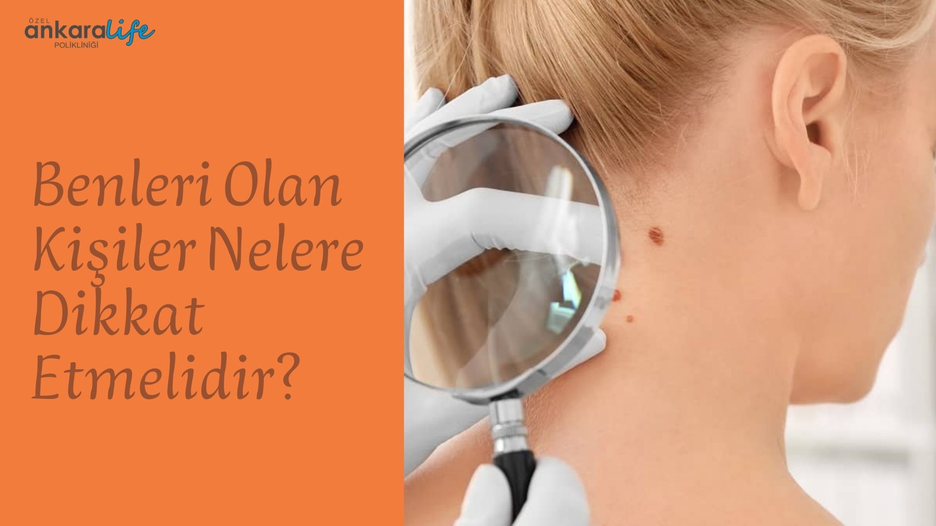 Benleri Olan Kişiler Nelere Dikkat Etmelidir