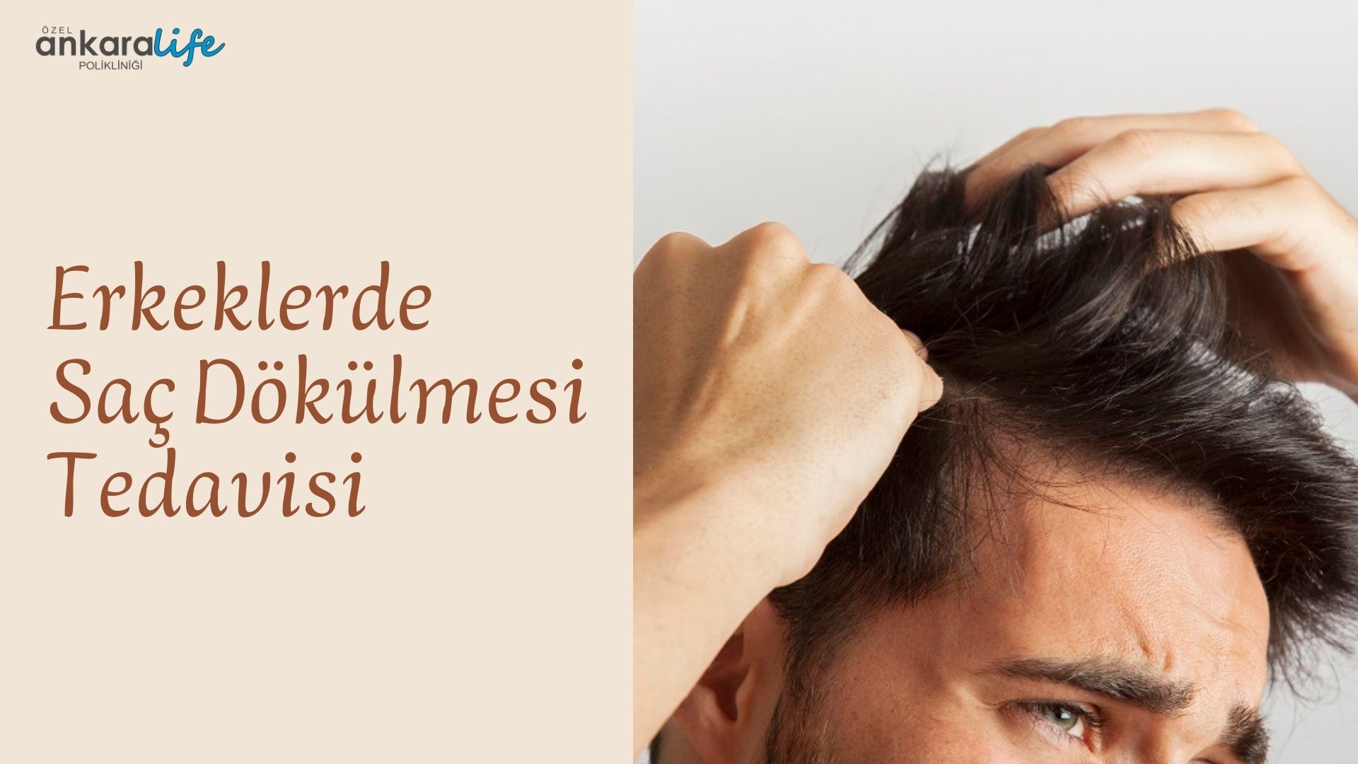 Erkeklerde Saç Dökülmesi Tedavisi