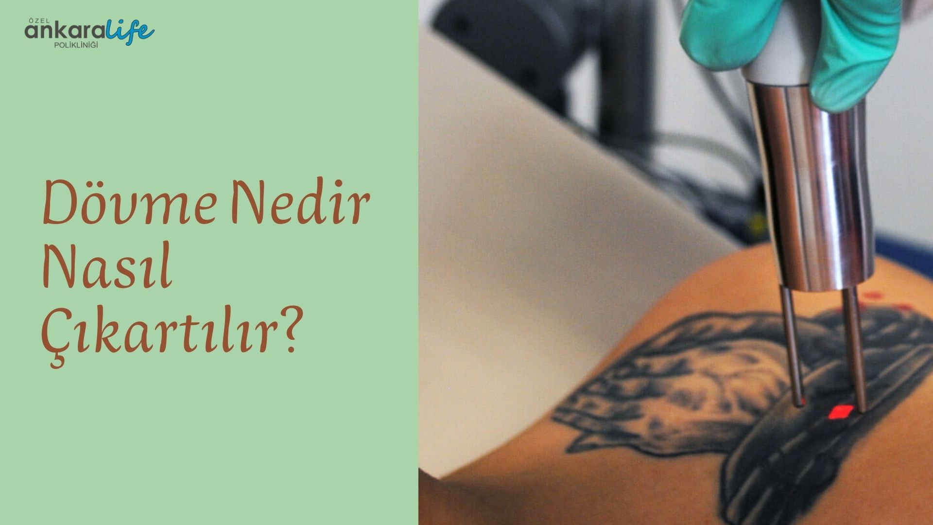 Dövme Nedir Nasıl Çıkartılır
