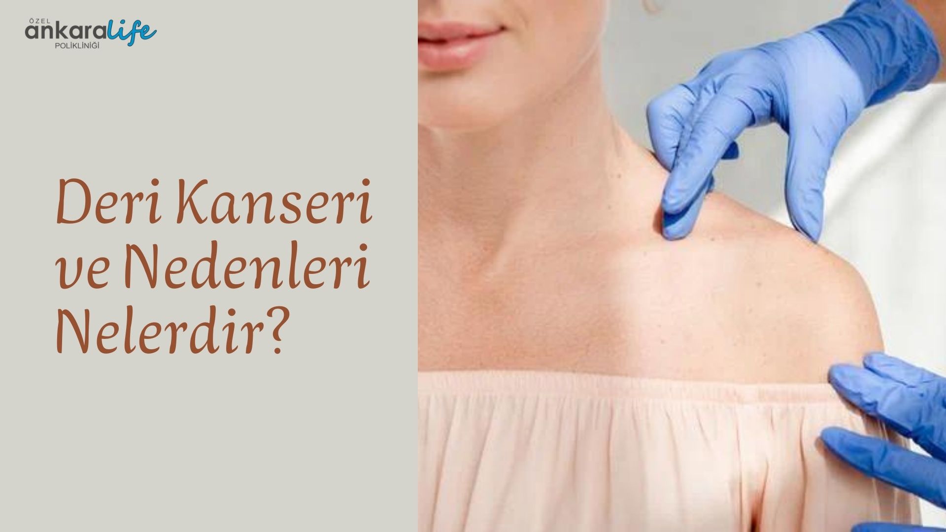Deri Kanseri ve Nedenleri Nelerdir
