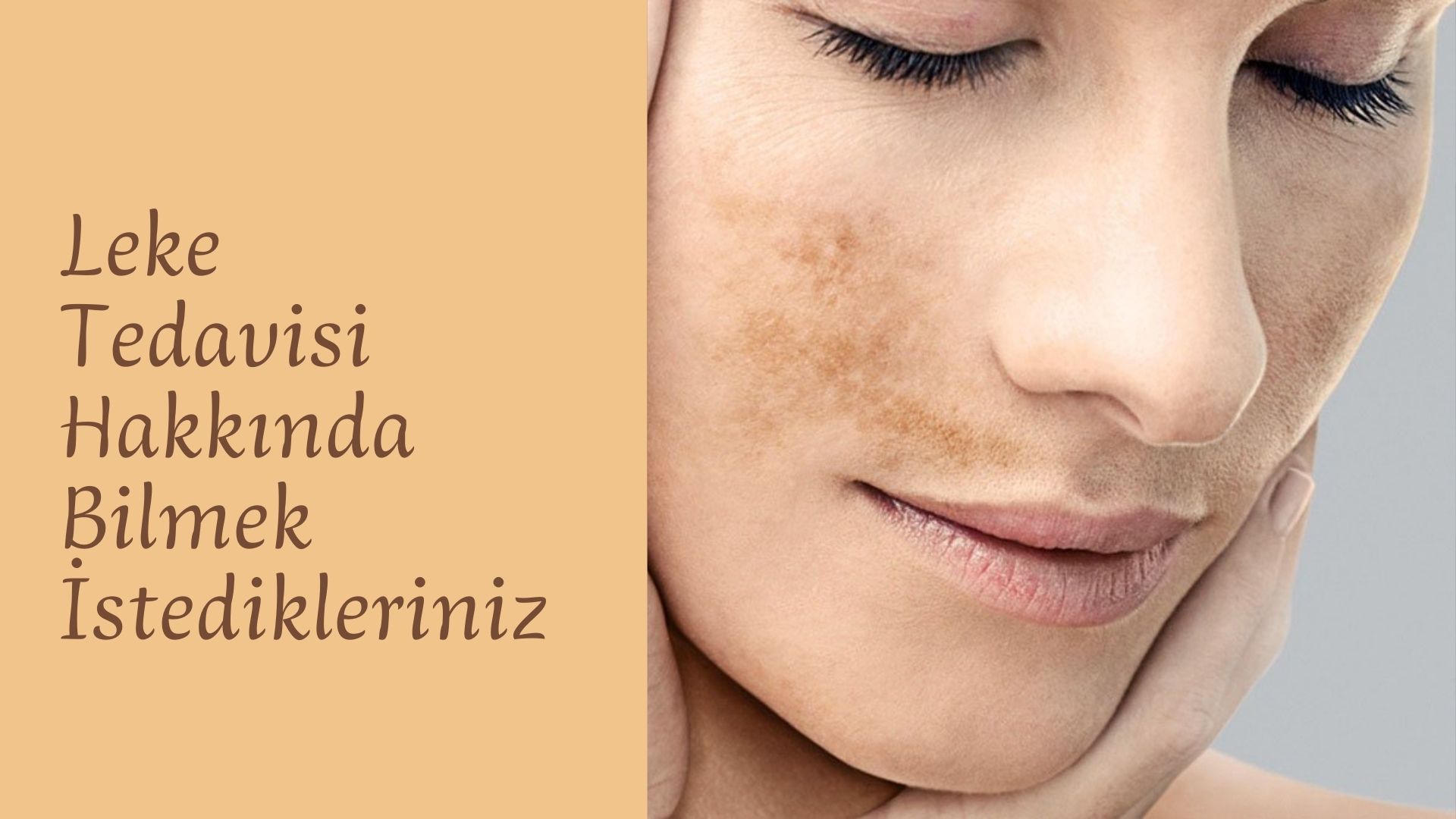 leke-tedavisi-oncesinde-nelere-dikkat-etmeliyim