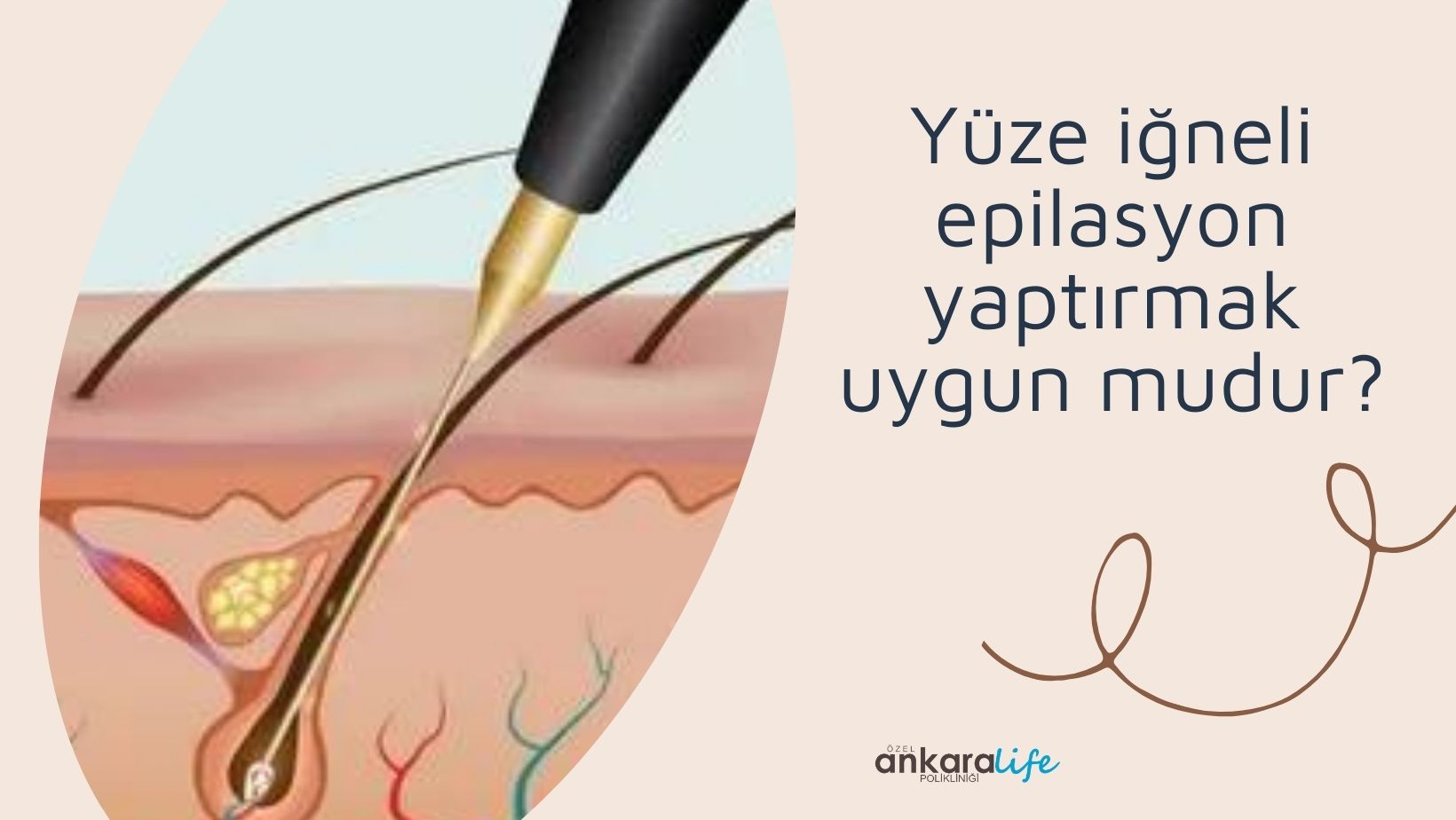 yuze-igneli-epilasyon-yaptirmak-uygun-mudur