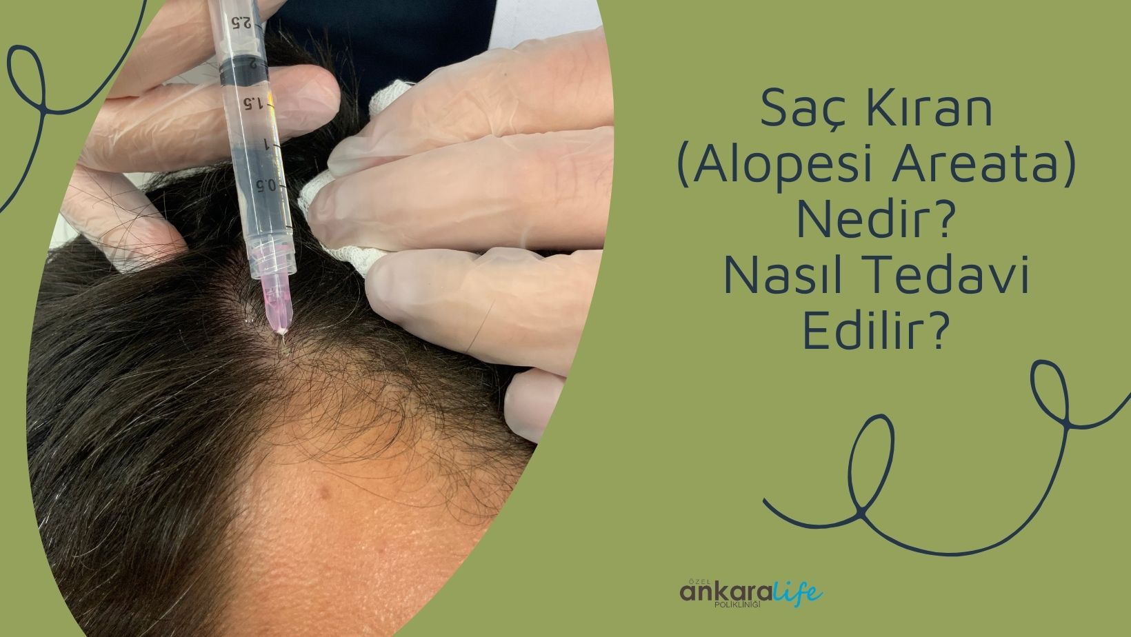 sac-kiran-nedir-nasil-tedavi-edilir