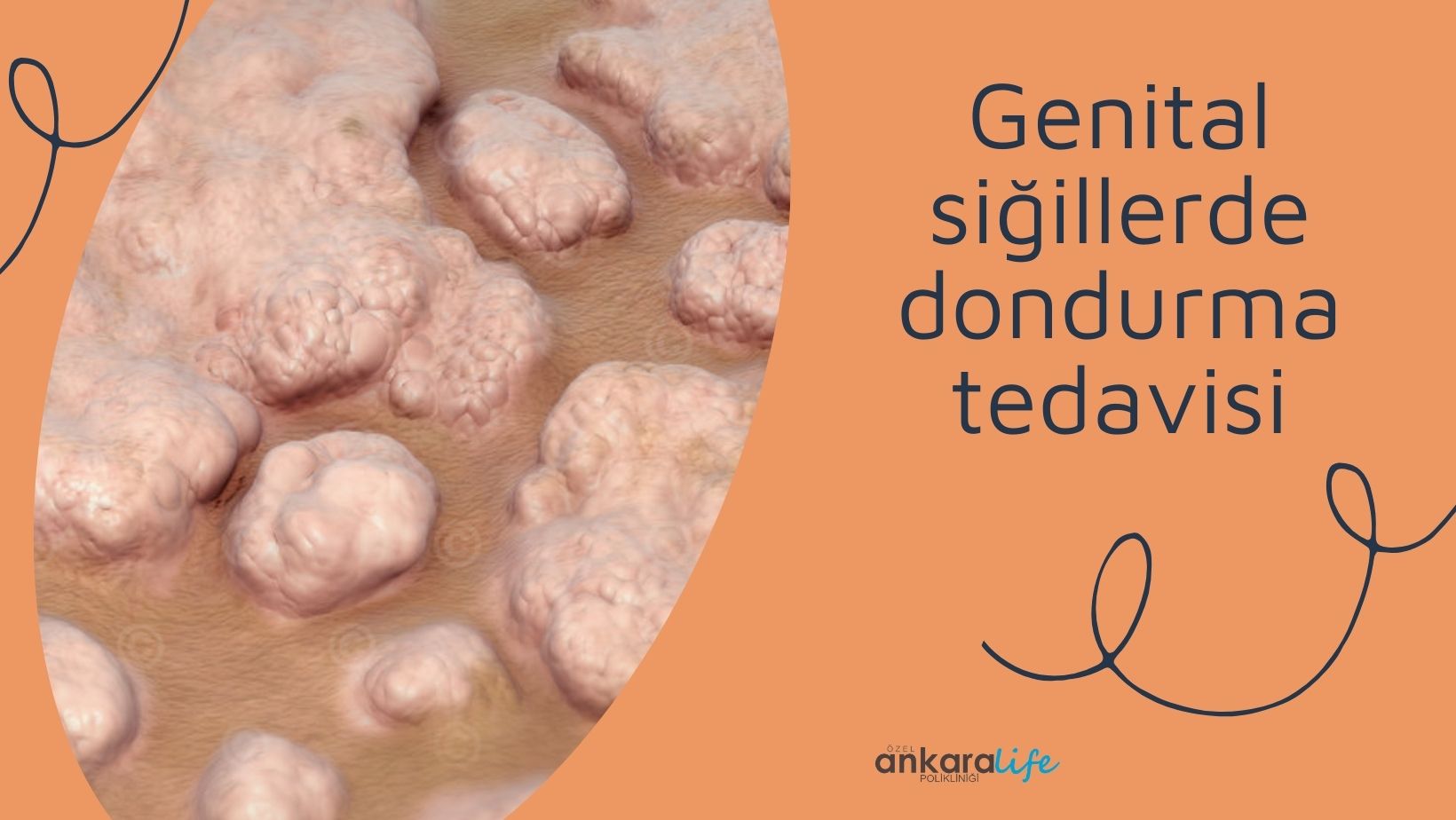 genital-sigillerde-dondurma