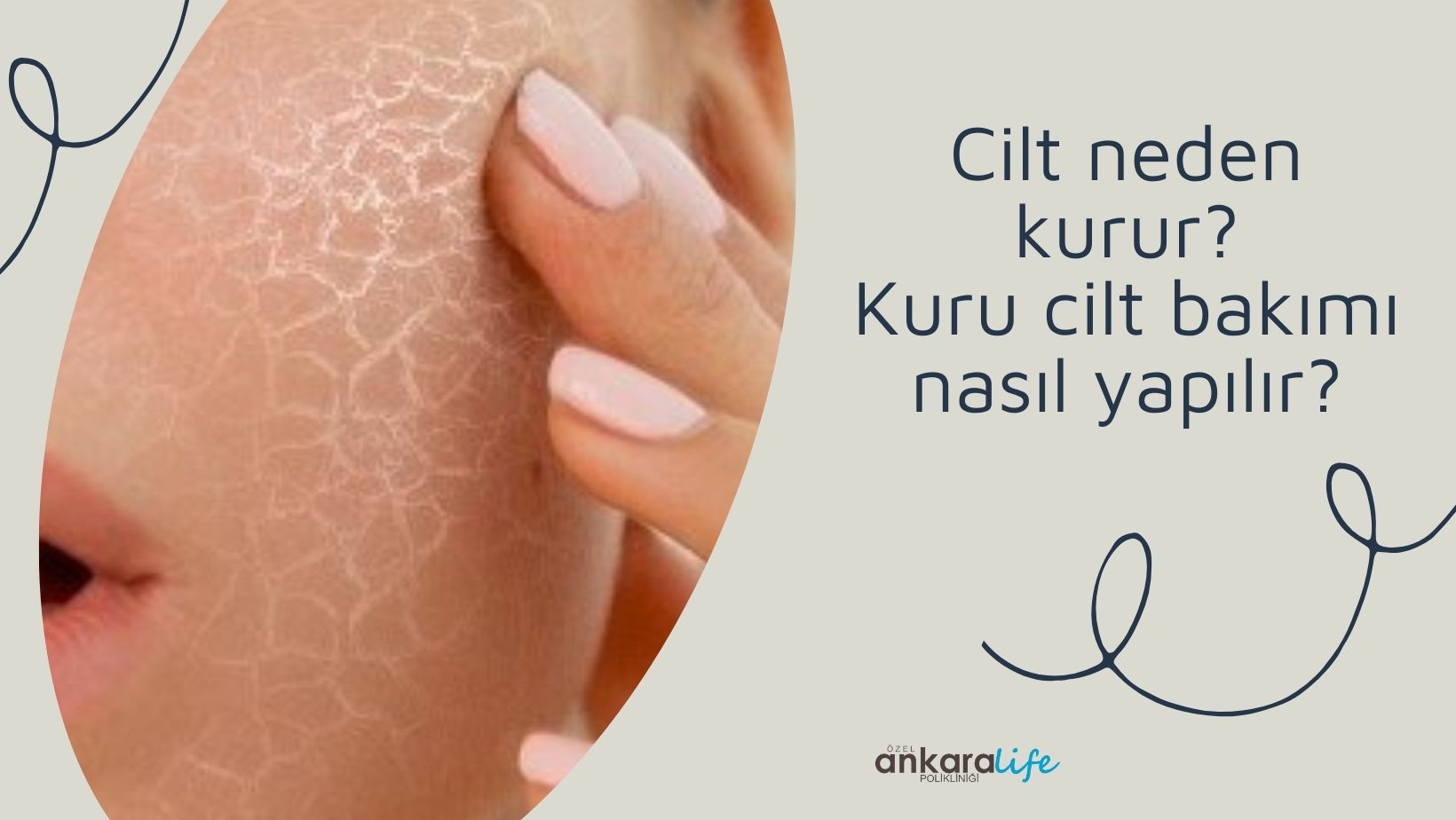 cilt-neden-kurur