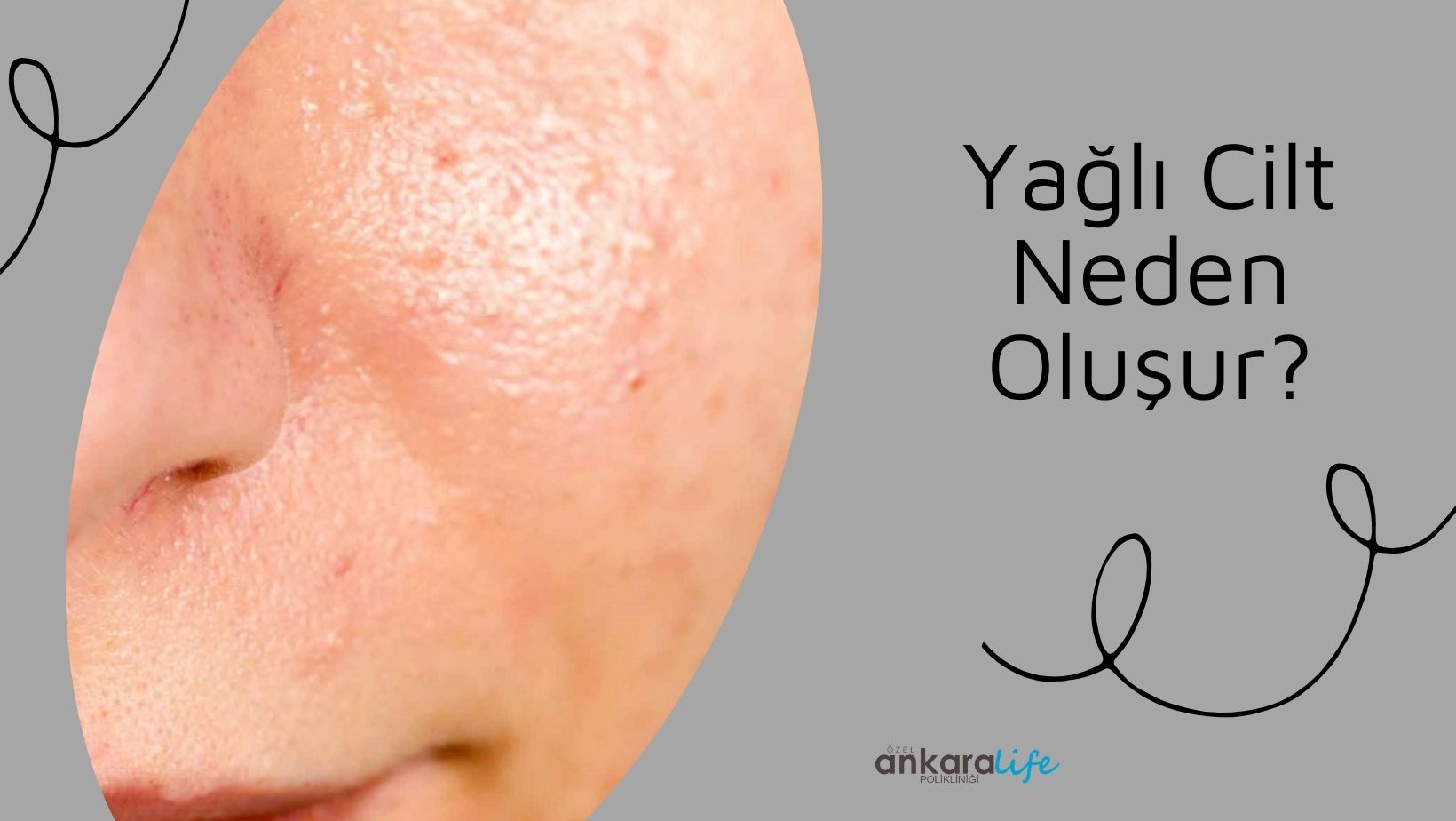 yagli-cilt-neden-olusur-nasil-tedavi-edilir