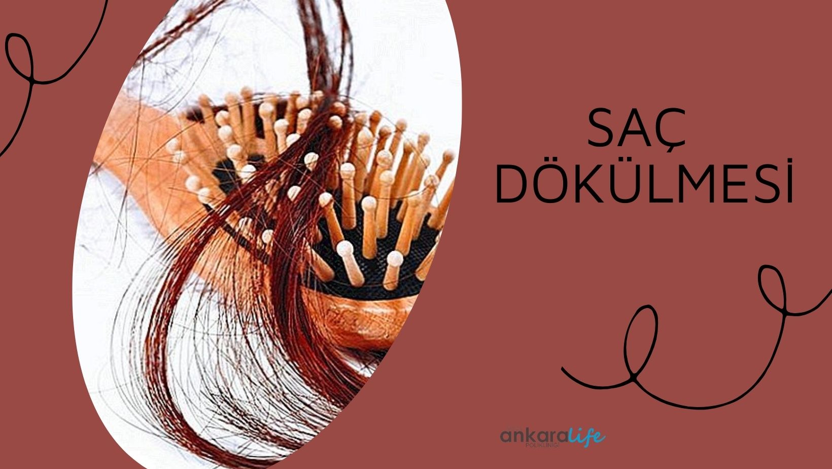 sac-dokulmesi