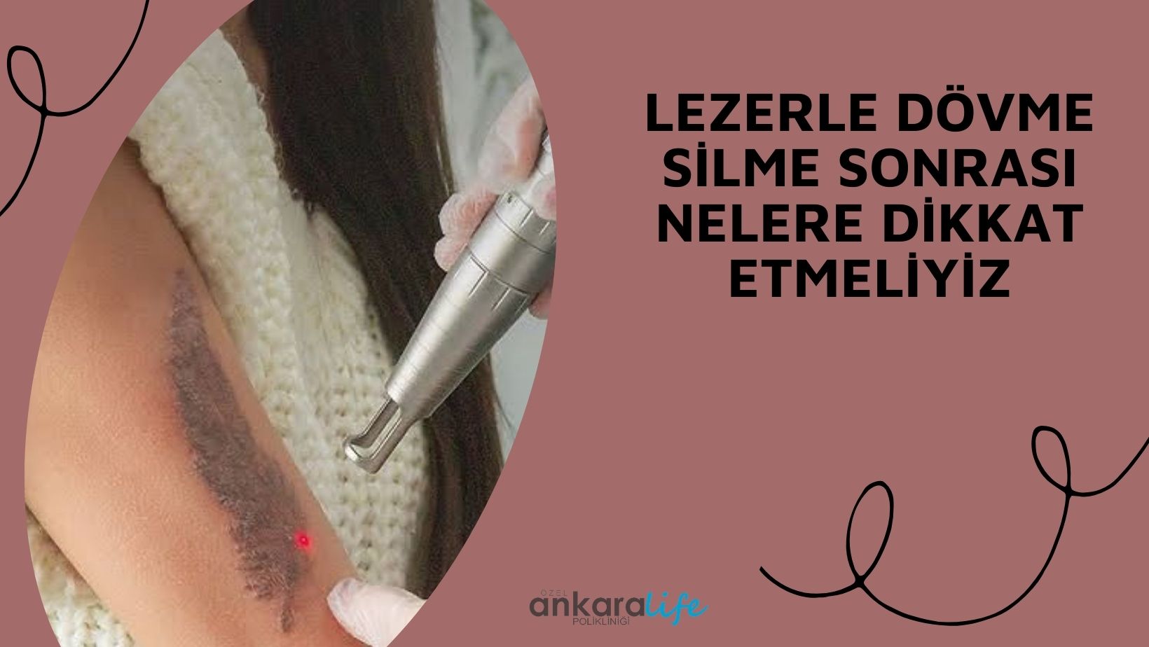 lazerle-dovme-silme-seansindan-sonra-dikkat-edilmesi-gerekenler