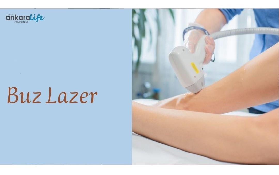 buz-baslikli-diot-lazer-laser