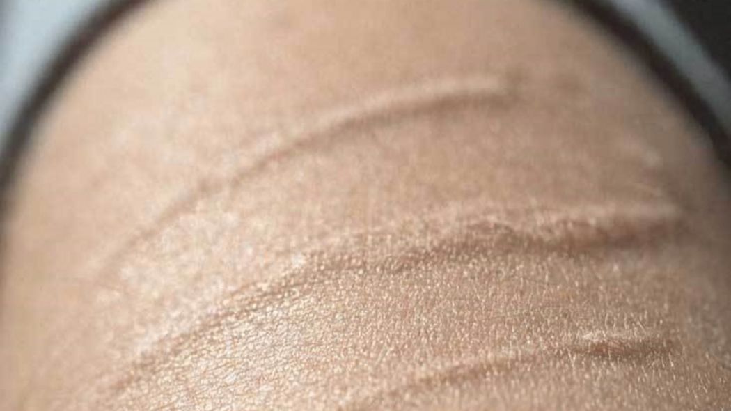 faca-izi-nasil-gecer