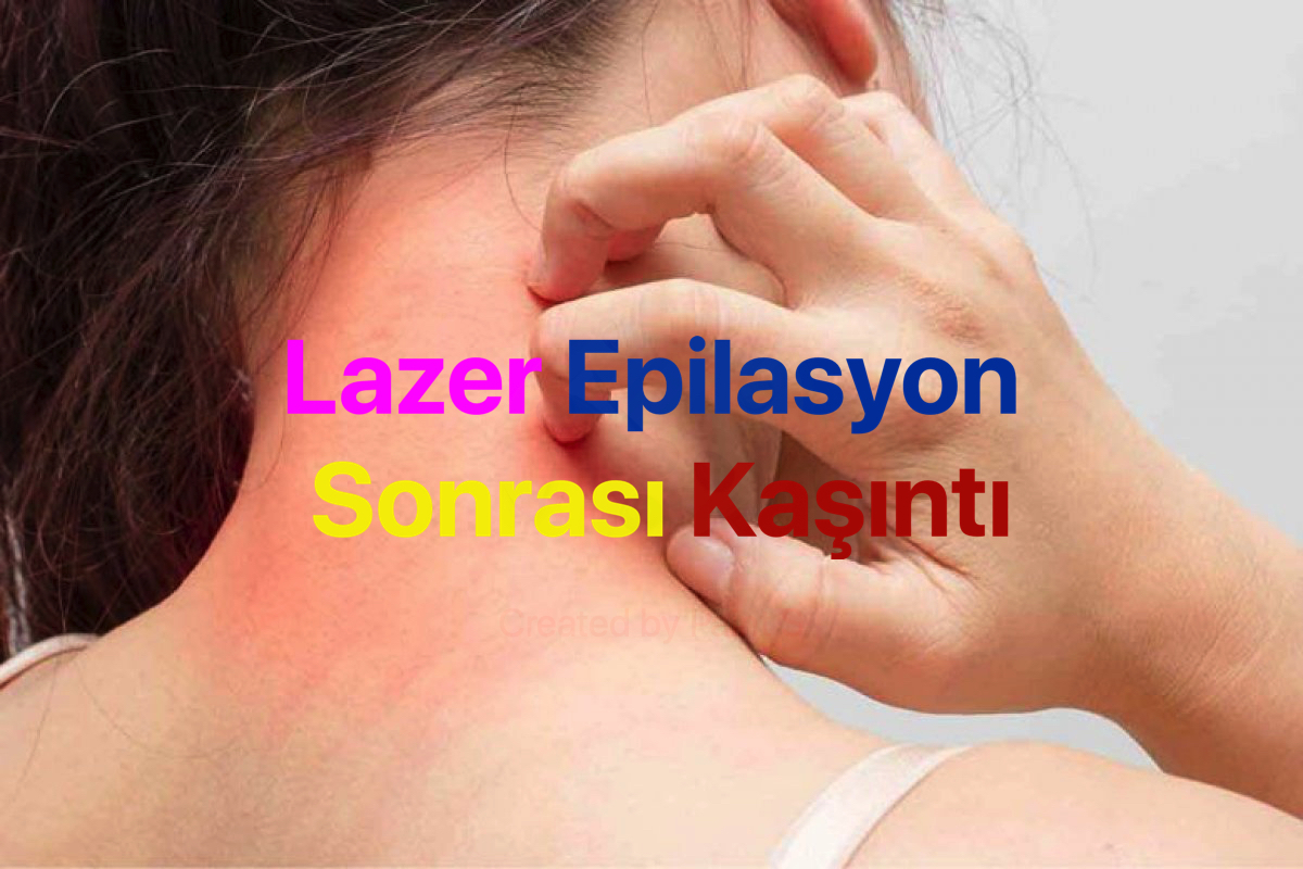 epilasyon-sonrasi-kasinti