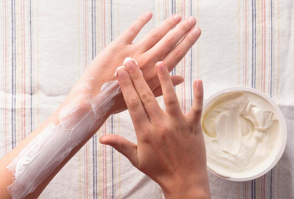 yanik-acisi-nasil-gecer