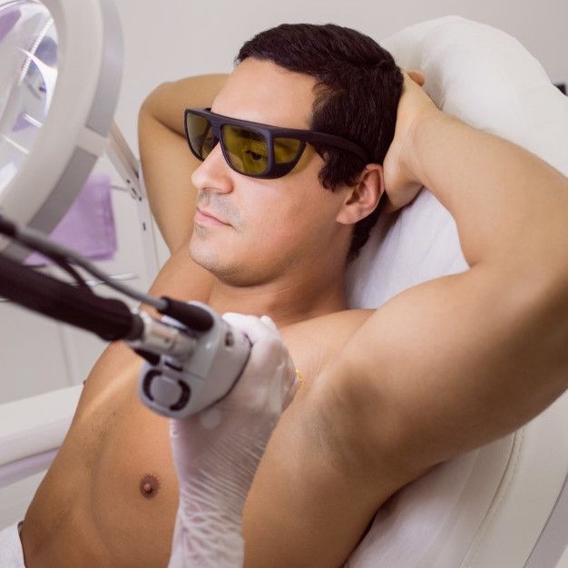 lazer-epilasyon-tum-vucut-kac-seans-surer