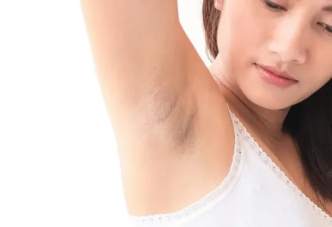 kol altı kararmasına ne iyi gelir