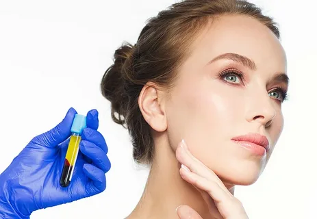 Which Areas Can PRP (Platelet Rich Plasma) Be Applied To, and What Is Its Role in Beauty?