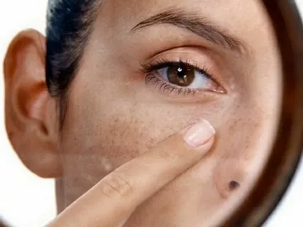 To Which Areas and Which Stains is Spot Treatment Applied?