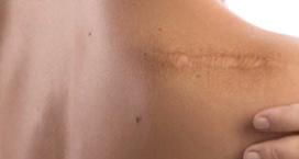 Dermatolog Doktor Fatma Yıldız