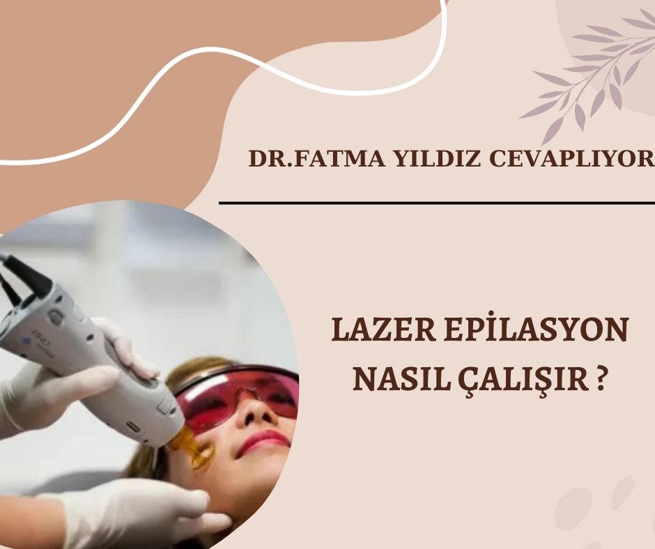 Lazer /Epilasyon/ Nasıl/ Çalışır ?